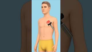 How Doctors Treat Severe Burns 