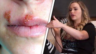 Has Mia Malkova Had STDs?