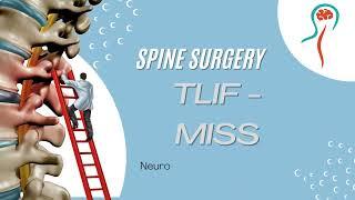 Spine Surgery. TLIF - MIS NeuroWellness India