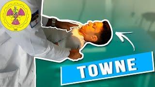 POSITIONING: TOWNE SKULL [SPECIAL]