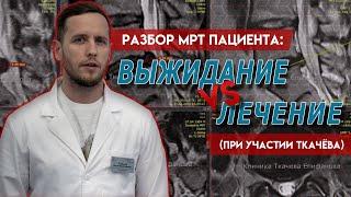 Мы ШАРЛАТАНЫ? | При грыже поможет только операция? | Разбор МРТ нашего пациента | Доктор Епифанов