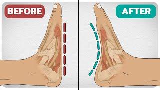 5 Exercises To Fix Flat-Feet (Fallen Arches)