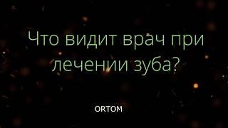 Почему стоматолог работает под микроскопом?