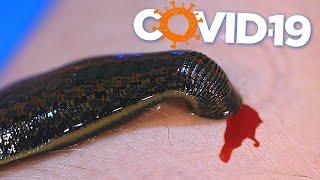 WHAT IF A LEECH IS DRINKED WITH THE BLOOD OF A COVID-19 Patient