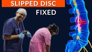 RECOVERY of SLIPPED DISC | Best Chiropractor in INDIA | Dr Sanjay Sarkar