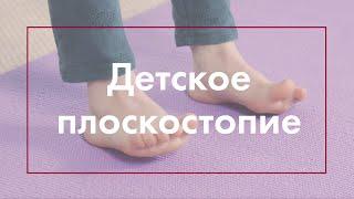 ПЛОСКОСТОПИЕ У ДЕТЕЙ. УПРАЖНЕНИЯ