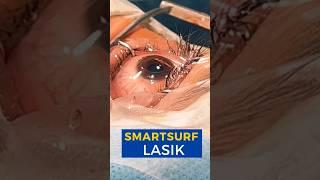 SmartSurf Lasik Surgery