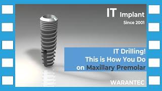 [warantec] IT Drilling! This is How You Do on Maxillary Premolar