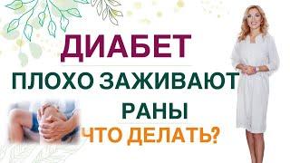  ДИАБЕТ: ПЛОХО ЗАЖИВАЮТ РАНЫ, МЕСТА УКОЛОВ ИНСУЛИНА, ЧТО ДЕЛАТЬ  Врач эндокринолог Ольга Павлова.