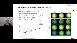 Clinical and Bioanalytical Aspects of Immune Monitoring via ELISpot