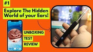 See What's Hiding In Your Ears - Watch This Otoscope Camera in Action Removing a Blackhead in  Ear