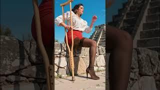 South American amputee beauty #amputeewoman #sak