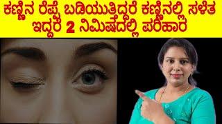 Eyelid throbbing, twitching of eye nerves | Watch video now for instant cure Twitching Eyes