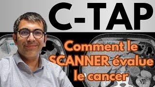 Scanner C-TAP pour évaluation et suivi des cancers : cas clinique démonstratif