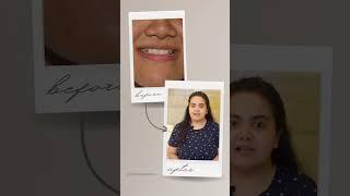 Surgical Procedure to Correct Misaligned Jaw | Jaw Alignment Correction Before & After |Royal Dental