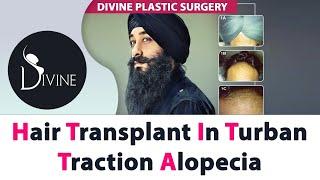 Hair Transplant in Turban Traction Alopecia