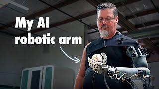 They're Building Him an AI Powered Robotic Arm