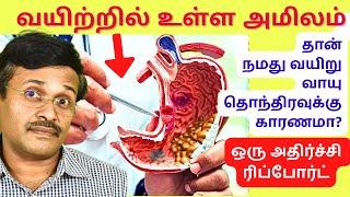 வயிறு வாயு hcl அமிலம் தொந்திரவு | hydrochloric acid stomach pain gas problem solution