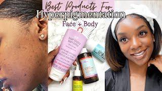 BEST PRODUCTS TO CLEAR HYPERPIGMENTATION | Get Rid of Dark Spots | Chavi Allie