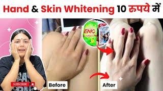 Feet And Hand Brightening Remedy | Pedicure And Manicure At Home | Dr. Upasana Vohra | Tan Removal