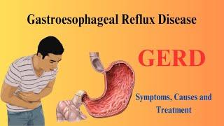 Gastroesophageal Reflux Disease (GERD): Understanding Symptoms, Causes, and Treatment