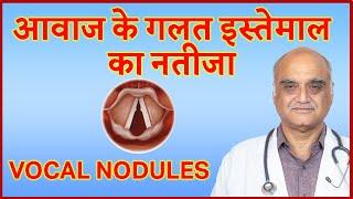 Vocal cord nodule : cause of hoarse voice । आवाज का भारी होना। Hindi। Dr. Rajive Bhatia