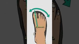 How Barefoot Shoes Fix Bunions #shorts