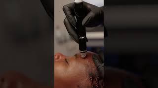 Reveal Radiant Skin: Step-by-Step HydraFacial Experience at Este Medical