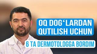 Oq dogʻlardan qutilish uchun 6 ta dermotologga borib natija ololmadim.