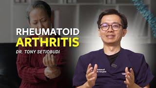  RHEUMATOID ARTHRITIS ATAU REMATIK  | DR TONY SETIOBUDI