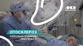 Стапедопластика - відновлення слуху прямо в операційній | MEDIKOM