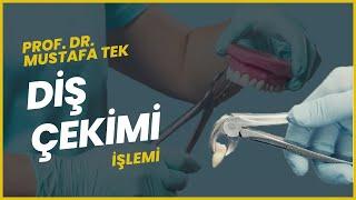 DİŞ ÇEKİMİ İŞLEMİ  |  PROF. DR. MUSTAFA TEK