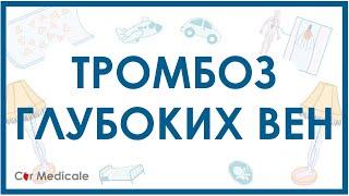 Тромбоз глубоких вен: что такое, симптомы, осложнения, принцип лечения