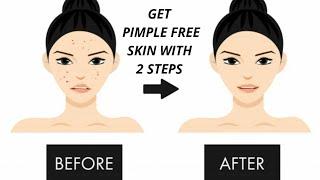 How to prevent pimple from skin|Beauty secret by samira