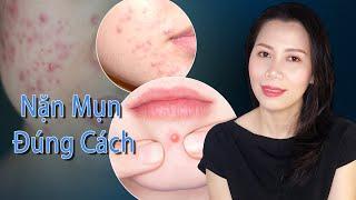 NẶN MỤN ĐÚNG CÁCH tại nhà | skincare da mụn Trang Siniskin