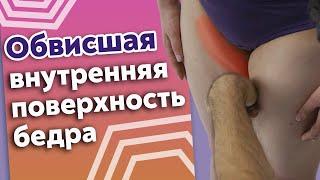 Что делать, если внутренняя поверхность бедра обвисла? / Как убрать целлюлит на бёдрах?