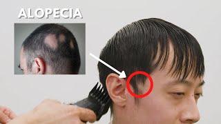 Watch How We Covered His Alopecia - Hair Consultation | 12 Pell