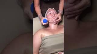 Facial Cupping Demonstration