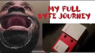 My Byte Journey |The FULL EXPIRENCE | A Keep it 100 Review #aligners #invisalign  #teeth