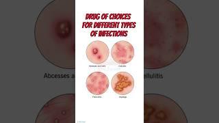 Antibiotics || Drug of choice || infection #docfever #pharmacology #antibiotics #disease #penicillin