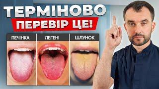 Язик попереджає про СЕРЙОЗНІ ПРОБЛЕМИ зі здоров’ям! Як діагностувати захворювання по ЯЗИКУ?