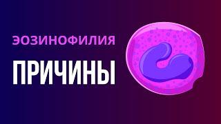 Эозинофилия. Каковы причины повышения эозинофилов. Диагностика эозинофильного лейкоцитоза