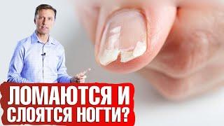 Ломаются и слоятся ногти? Как укрепить ногти