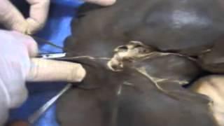 liver and diaphragm