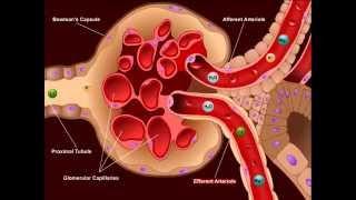 USMLE® Step 1 High Yield: Nephrology: Diuretics