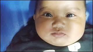 Lip tie ‼️ || Tongue-tie of 5month old infant || #whatilearntoday || ربطة عنق