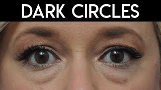 How to Fix Dark Circles