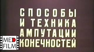 Ампутация конечностей (способы и техника). Академик В.В.Кованов © Amputation of the extremities