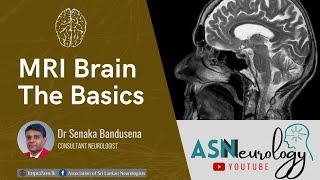 MRI Brain - The Basics by Dr Senaka Bandusena