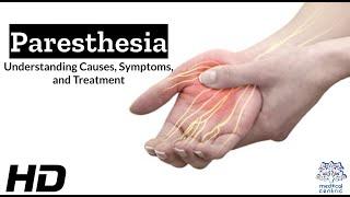 Paresthesia: The Shocking Sensation You Need to Know About